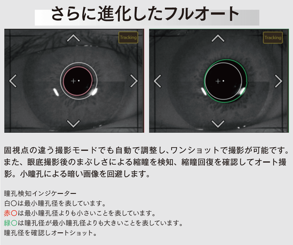 撮影ボタンをクリック→アライメントを自動で調整→撮影完了